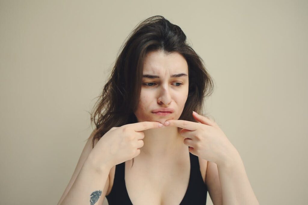 A Woman Tries to Pop a Pimple Between Two Fingers as Acne Treatment