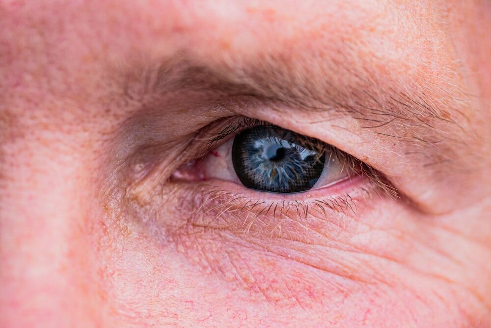 Closeup of a Man’s Eye Area Shows Wrinkles and Fine Lines